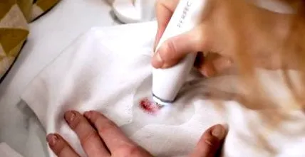 ultrasonic review