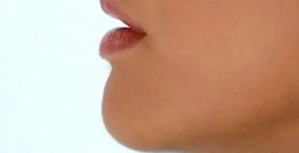 брадичка