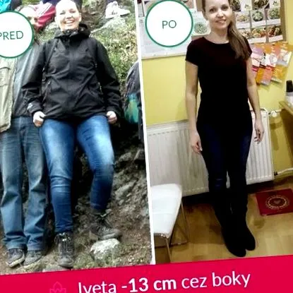 consiliere nutrițională