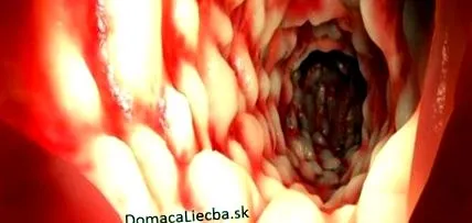 vacsorára egymás