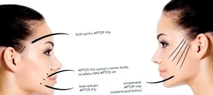 aptos