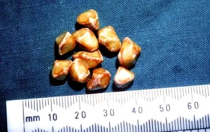 liver