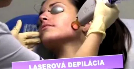 laser