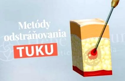 metode chirurgie