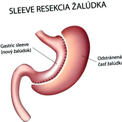 rendkívül
