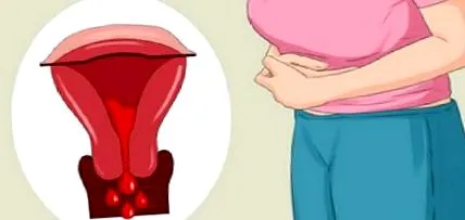 menstruációnak ciklusnak