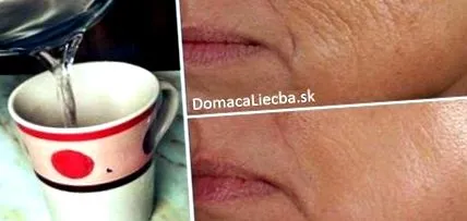pielea dumneavoastră