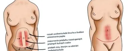 peretelui
