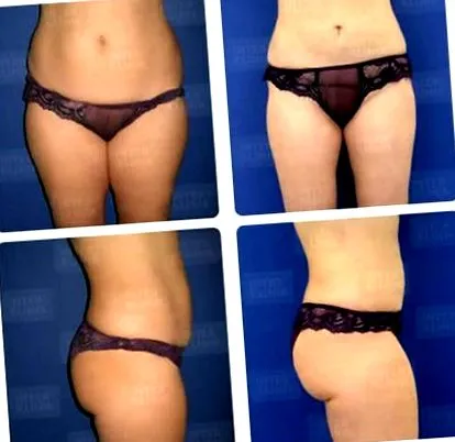 chirurgie chirurgie