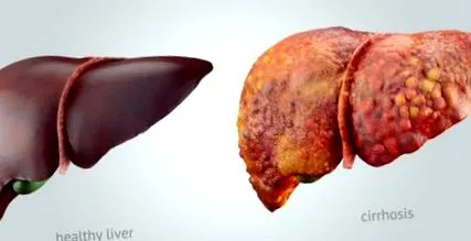 enciclopedia cauza este