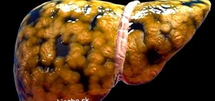 hepatică