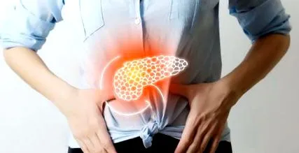 pancreatitei
