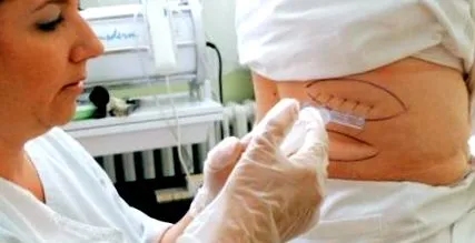 grăsimi injecție