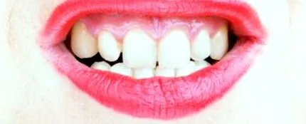 gingiile tale