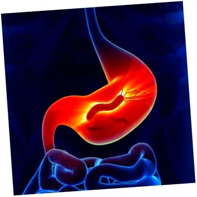 terapia duodenal