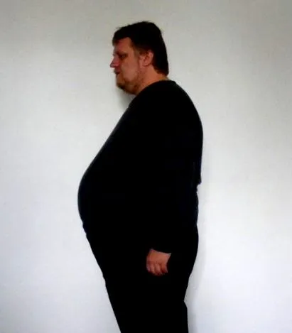 marian intestinului subțire
