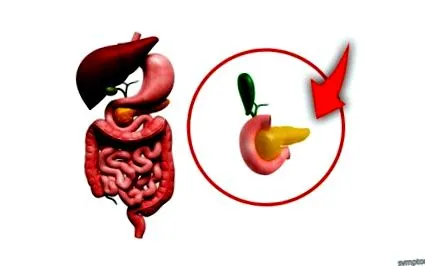 inflamația inflamația