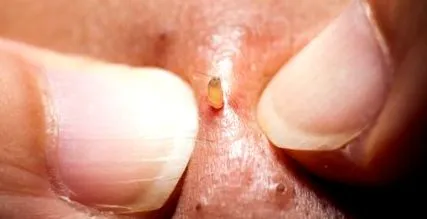 extrudarea
