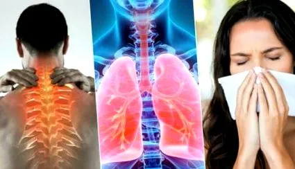 pulmonar