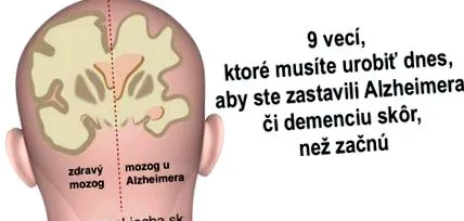 направите