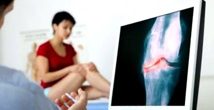 osteoartrita poate