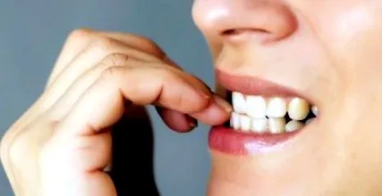 trükkök