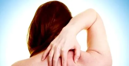 eczema răzătoare