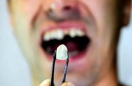 denticor