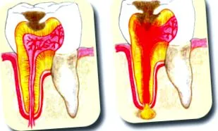 dentară clinică