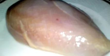 шунка
