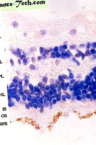 retinele exprimarea