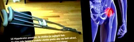 șoldului osteoartrita