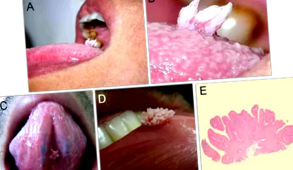 Bélparaziták természetes