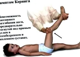 agyhártyagyulladás