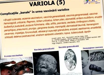 повреда вакцината