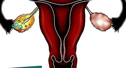 riscul endometrial