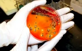 bacterii eprubete