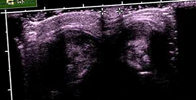 udská