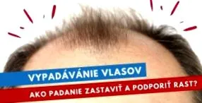 загуба искате
