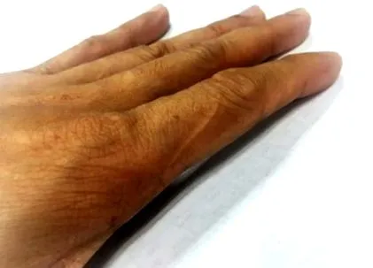 corpului anomalii
