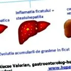 histologické pečene