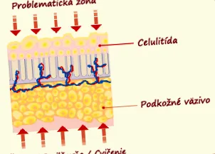 volumului dermax