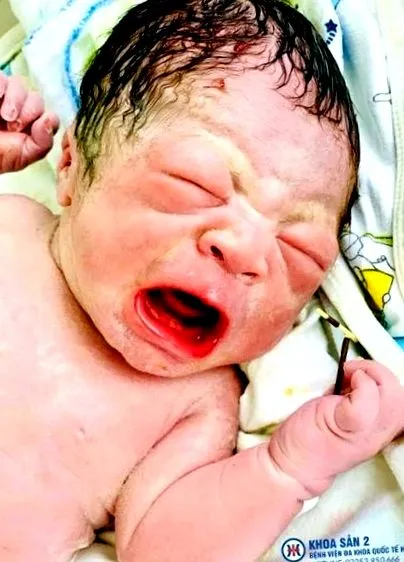 baby fotó