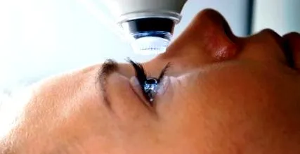 laser laser
