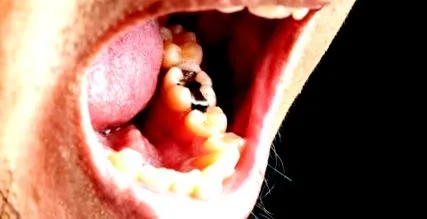 pentru dentist