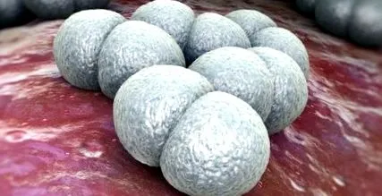krtíš