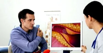 számít véna