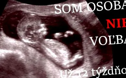 sono