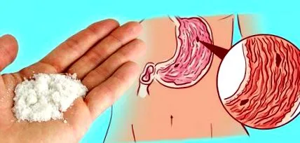 utilizarea