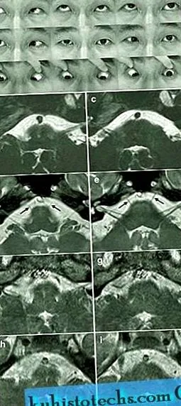 diagnosticul duan